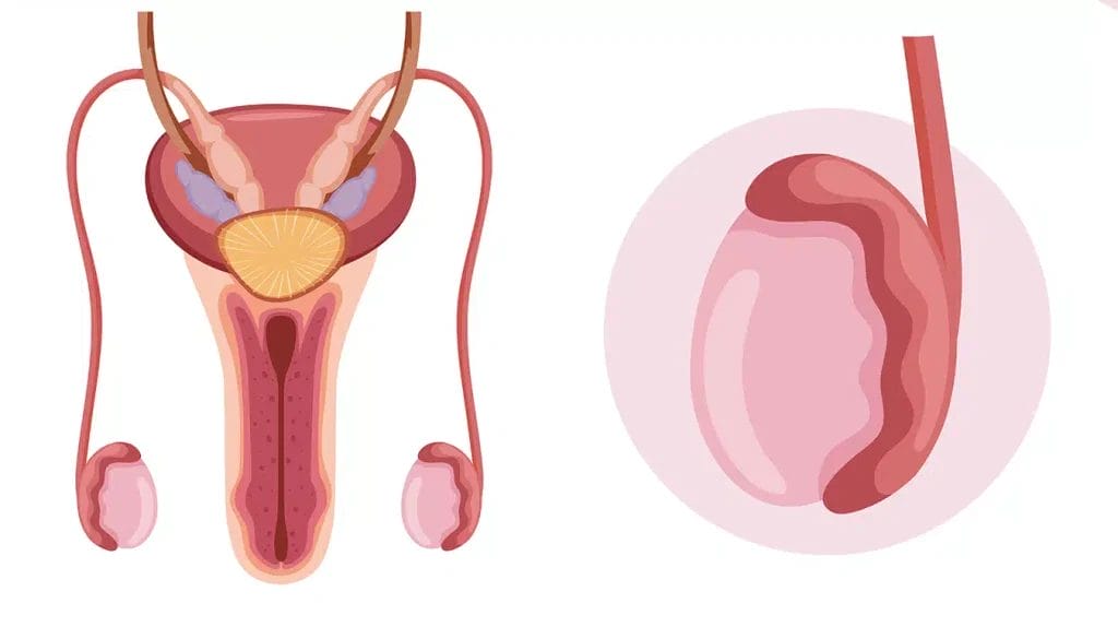 Testicular Cancer Treatment Dr Zubair Cheema